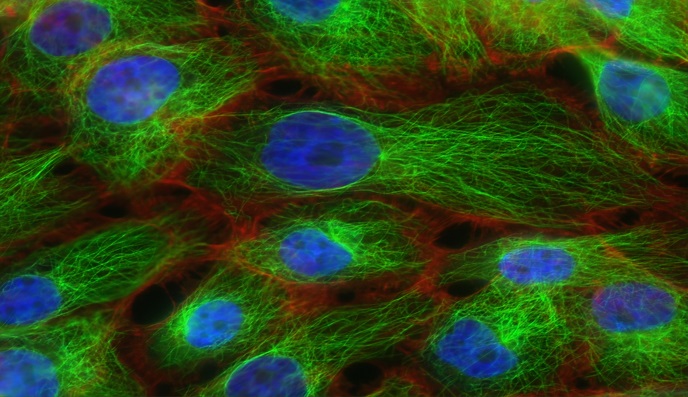 Breast Cancer Classifier